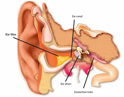 Earwax and Other Ear Infections: A Comprehensive Guide